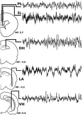 Sleep-Dependent Oscillatory Synchronization: A Role in Fear Memory Consolidation